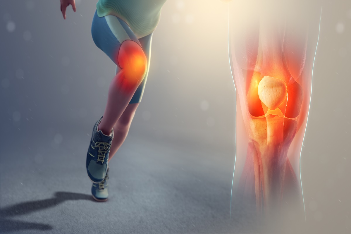 Patellofemoral Pain