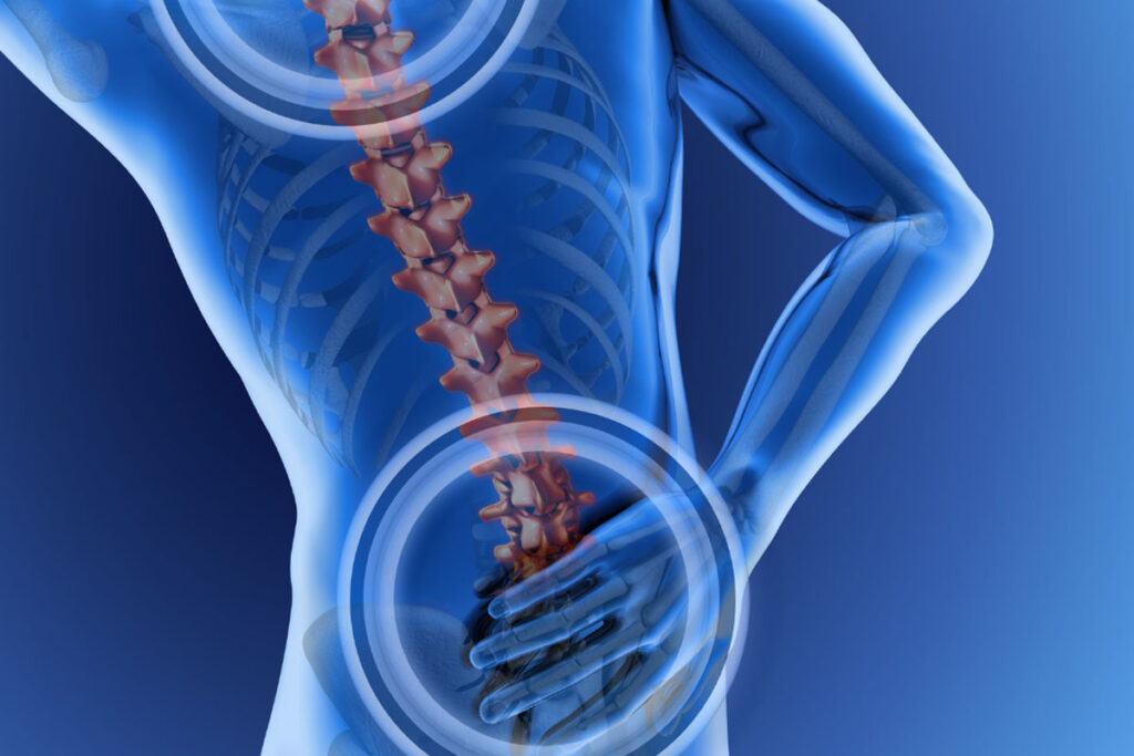 Disc Injury Back Pain